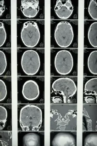 MRI dla zdrowia