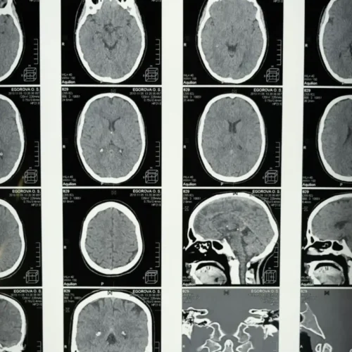 MRI dla zdrowia, czyli badanie rezonansem magnetycznym